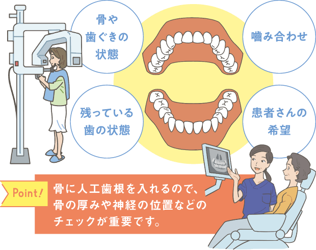 骨に人工歯根を入れるので、骨の厚みや神経の位置などのチェックが重要です。